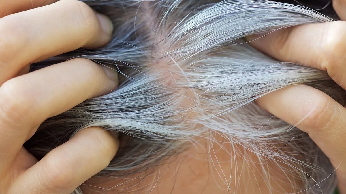 Illustration comparing pigmented and gray hair follicles